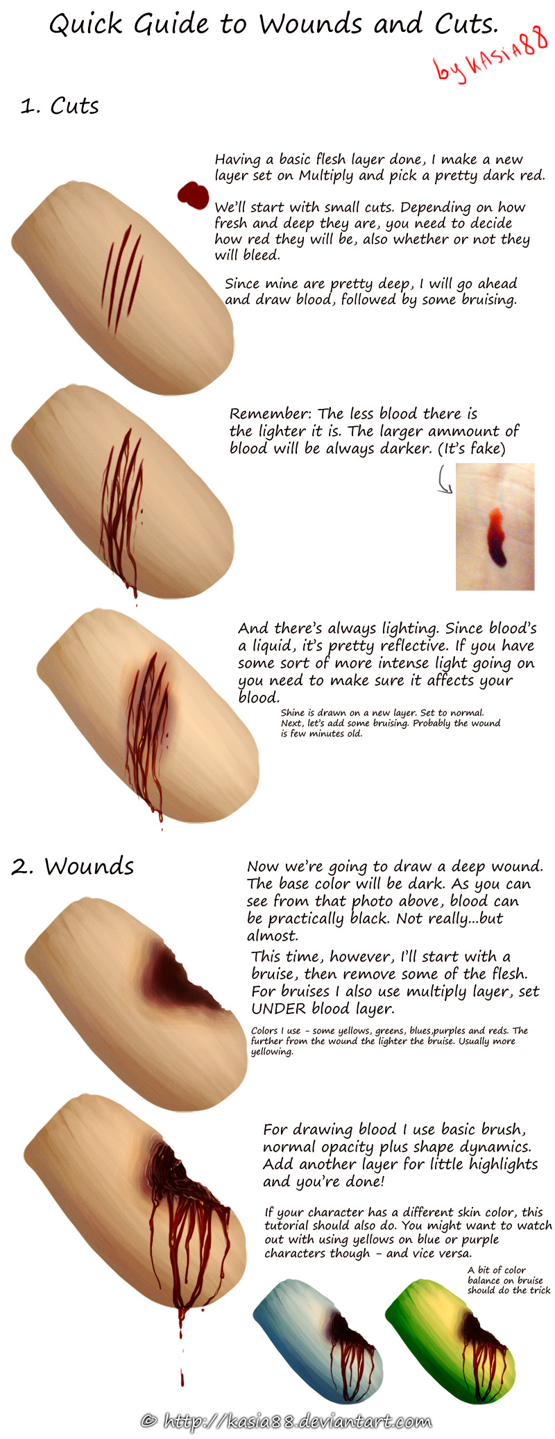 quick guide to wounds and cuts