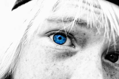 Eye