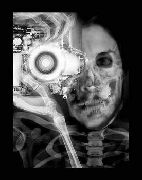 X-RAY selfportrait