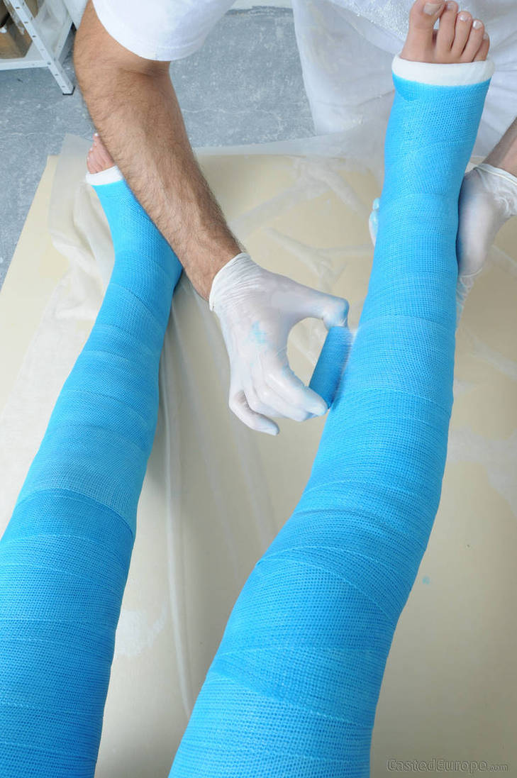 Term Leg Cast Cute girl in double long leg casts Untitled by Tangbag124 on DeviantArt