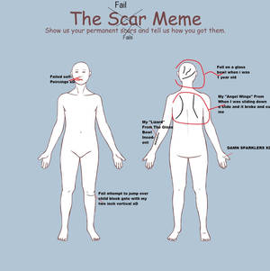 The Scar Meme :D