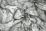 Surgery by Catakumba