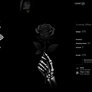 Steam Artwork - Dead Roses