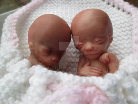 14 week gestation twin baby girls in angel pocket