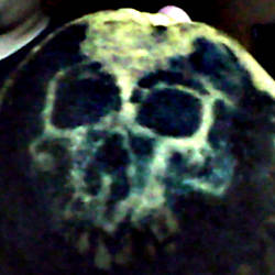 Lame skull