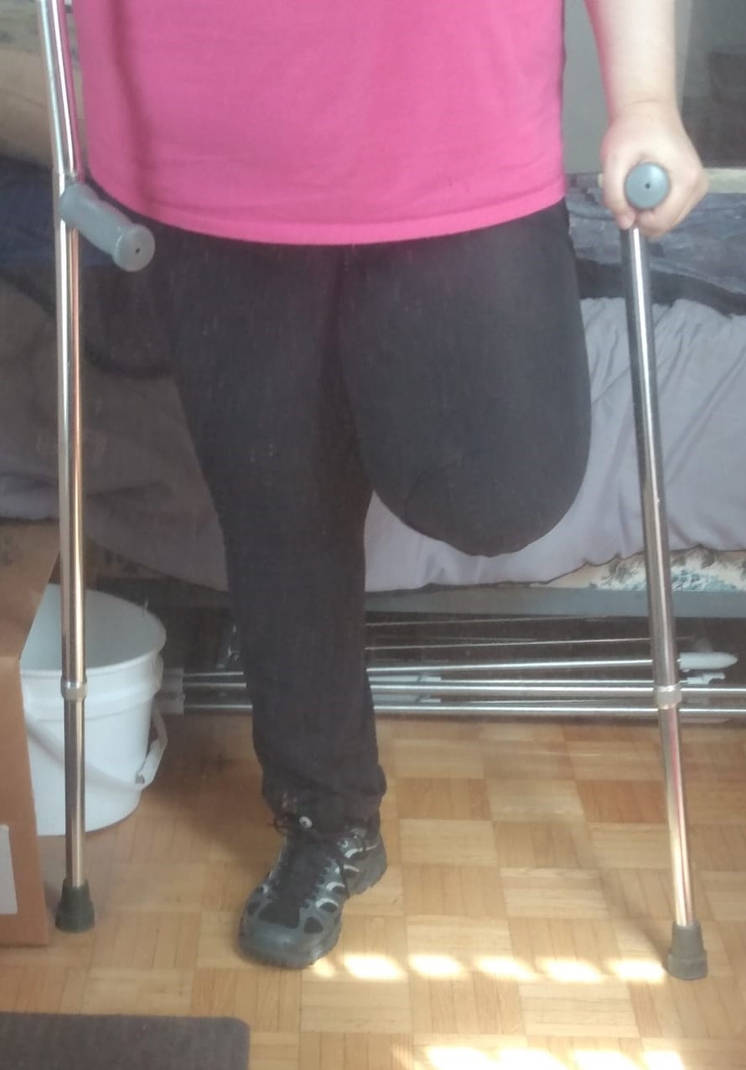 One Leg 5 by LarryArch on DeviantArt