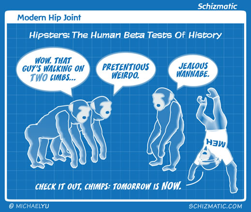 Modern Hip Joint