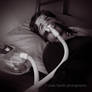 Sleep Apnea