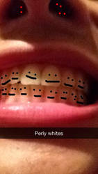 Perly Whites