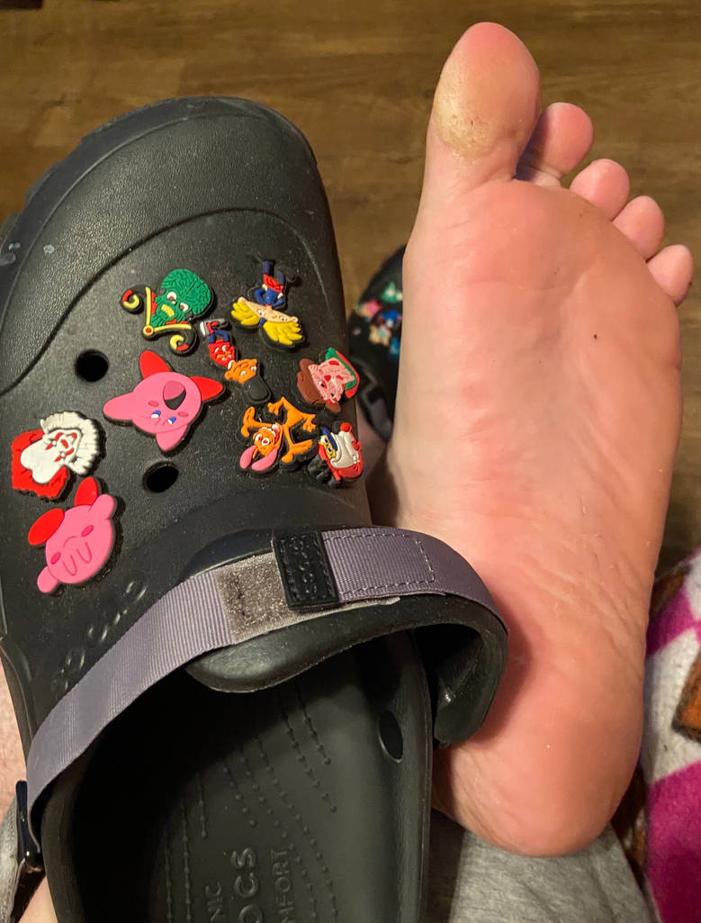 Sweaty Left Foot W Crocs By Tinycub88 On DeviantArt sweaty-left-foot-w-crocs-by-tinycub88-on-deviantart