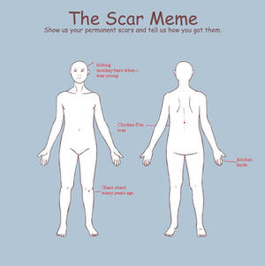 Scar meme