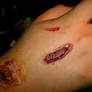 Latex wound