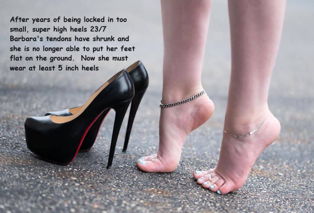 Shortened Tendons By StoogesUE On DeviantArt shortened-tendons-by-stoogesue-on-deviantart