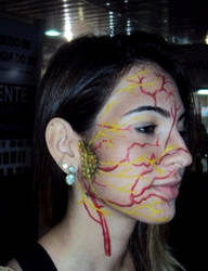 Facial Nerve and Artery