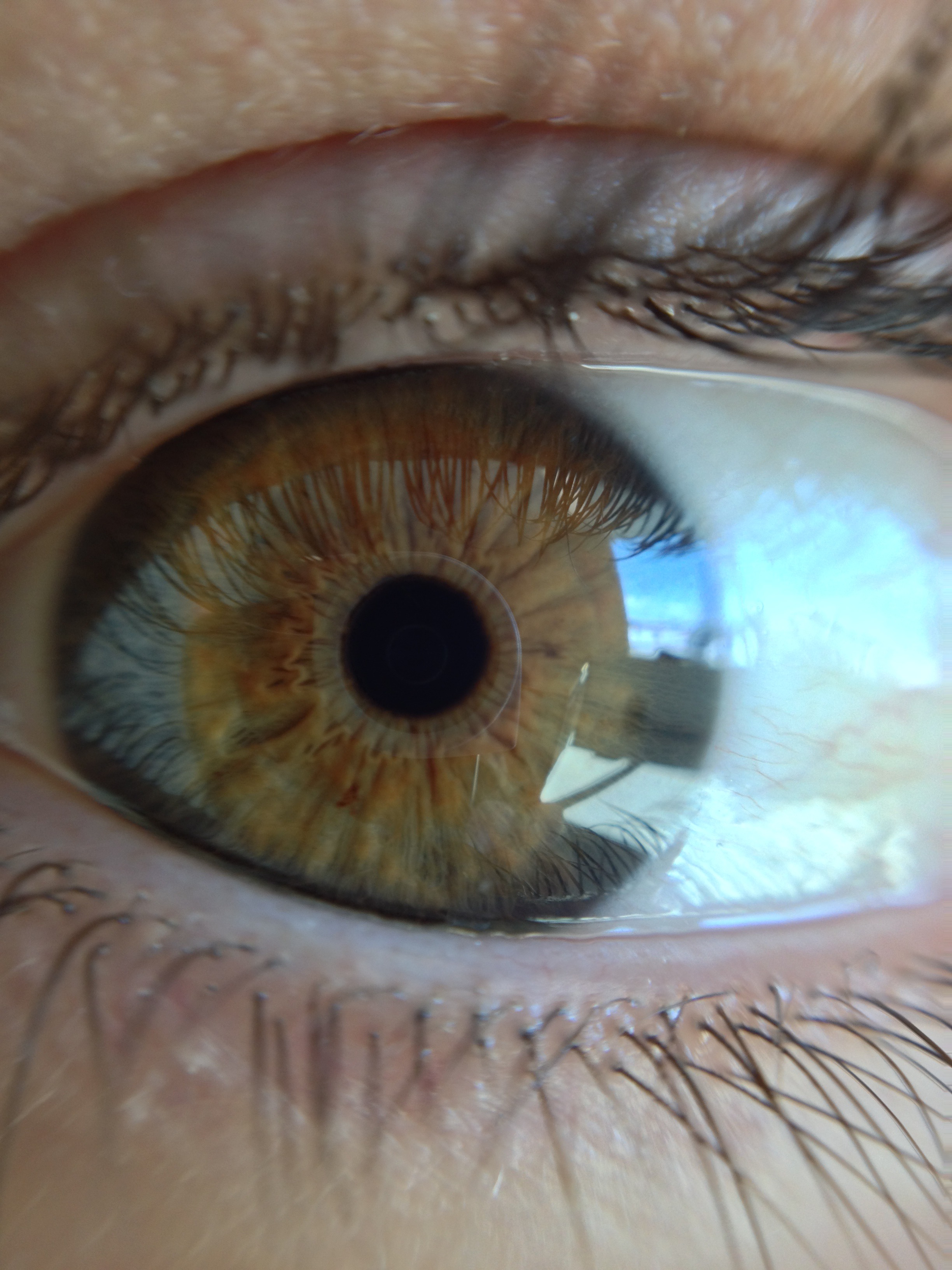 Hazel eye