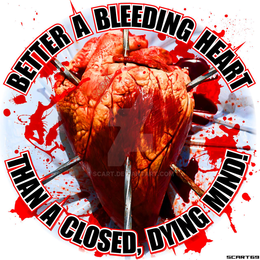 Better a Bleeding Heart, Than a Closed Dying Mind!