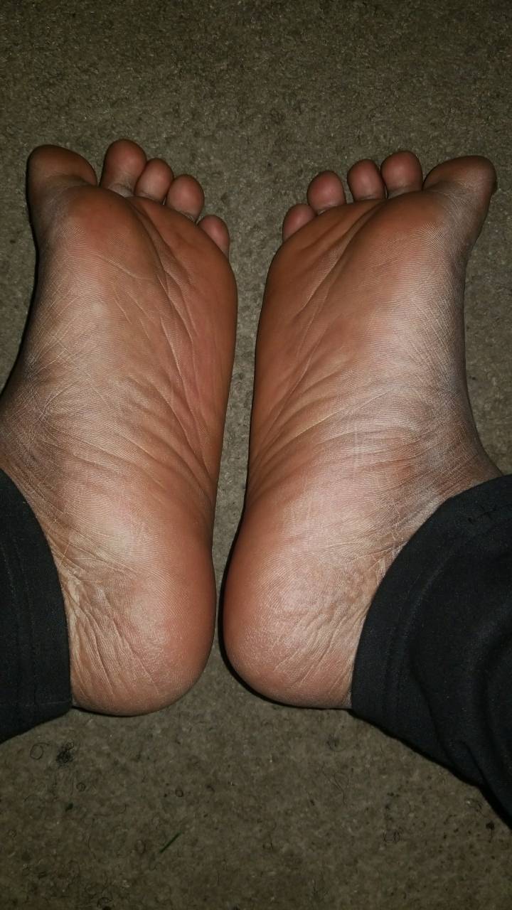 Mature Plump Feet