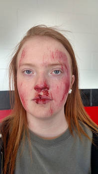 Mock Crash Victim 1