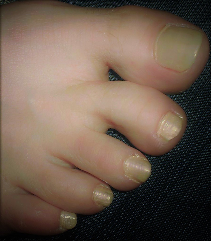 Silver Toes by 2030ggooll on DeviantArt