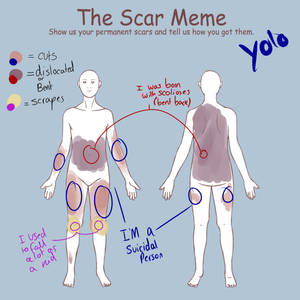 MEME: Scar meme