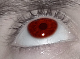 my eye