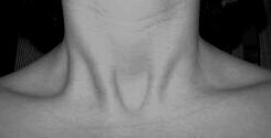 The beauty of a collar bone