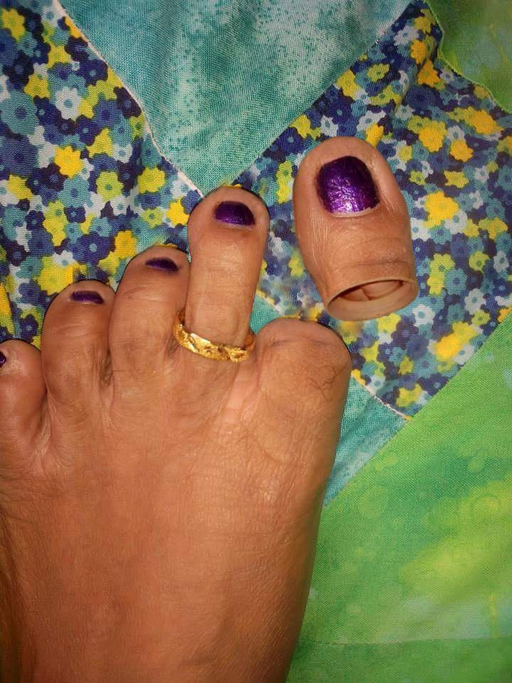 Big toe cut off by Ellyshabeth on DeviantArt