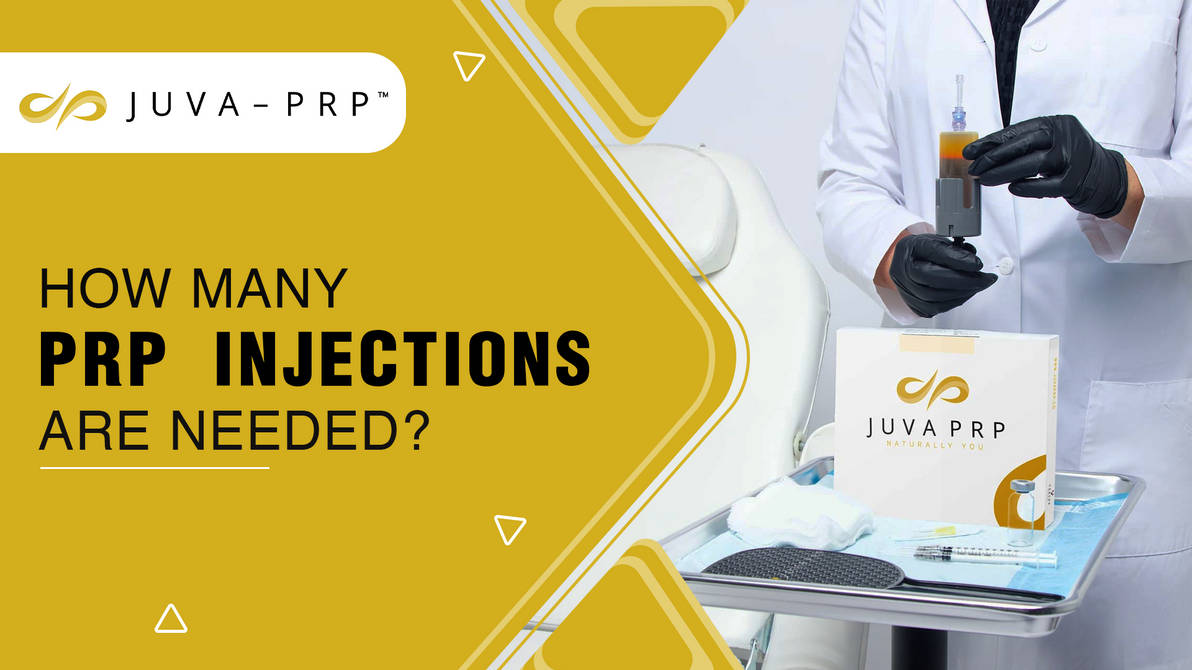 How Many PRP Injections are needed? by juvaprp on DeviantArt