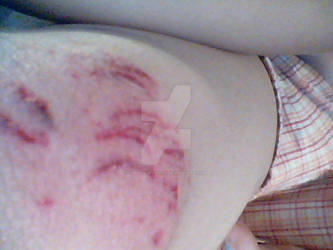 cut on my leg