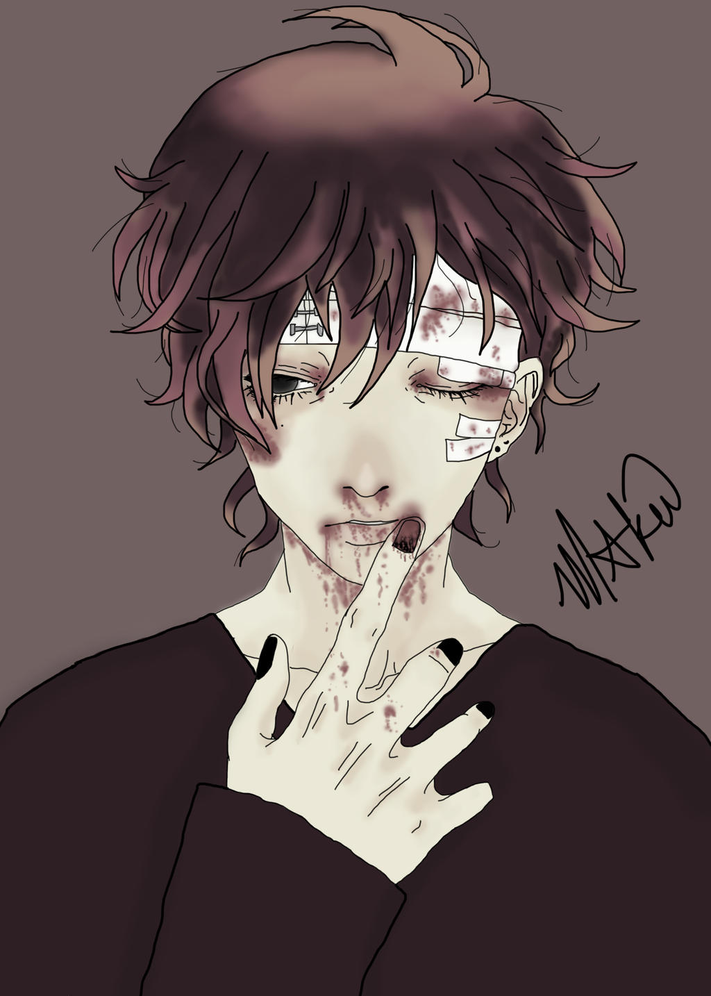 Re-Creation) Anime Guy -injured- by shiro-space-daddy on DeviantArt