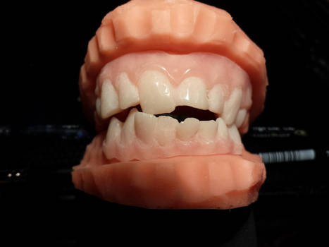 Custom Acrylic Dentures