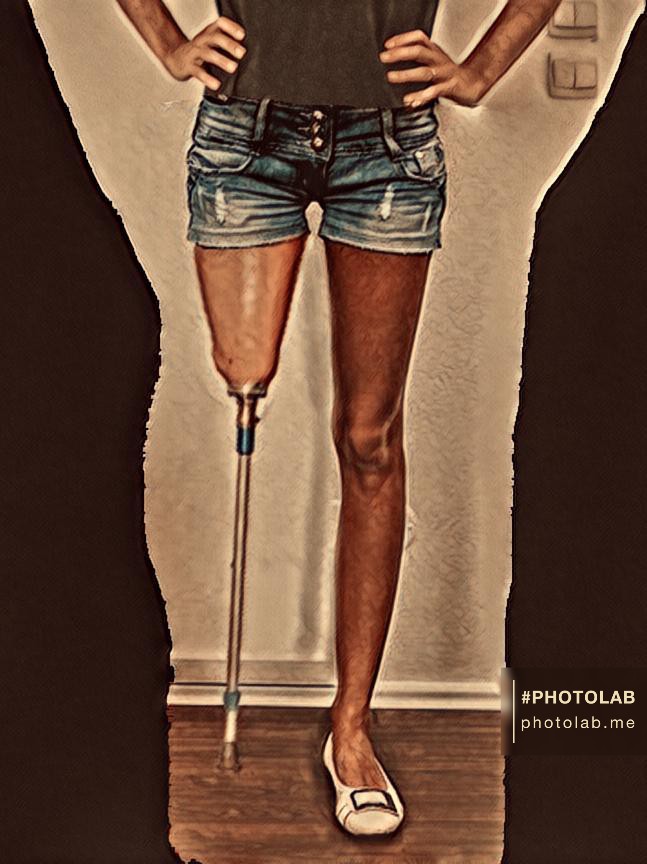 Leg Modification Deviantart Jeans short and pegleg by Amputights on DeviantArt