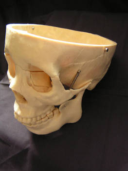 Skull 24