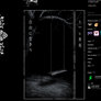 Steam Artwork | Creepy Tree Swing