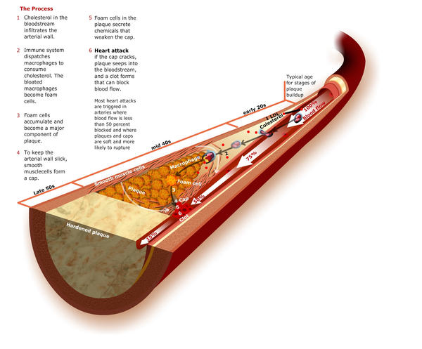 Arter Deadflow artery by fluidcreativestudio on DeviantArt