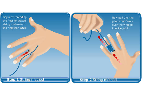 Ring Ridge Remove how to remove a ring by fluidcreativestudio on DeviantArt