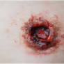 Bullet Wound CU