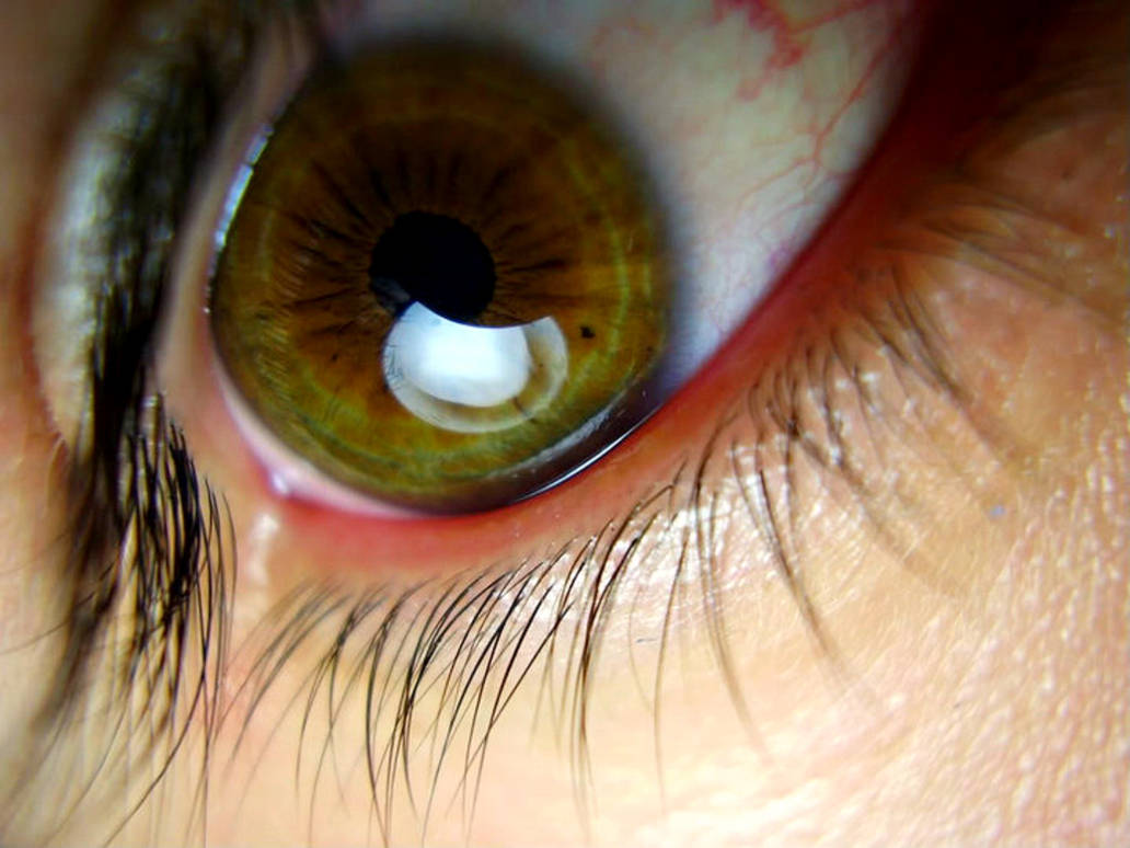 Sharp Eye Example Sharp Eye by ignoretheweapons on DeviantArt