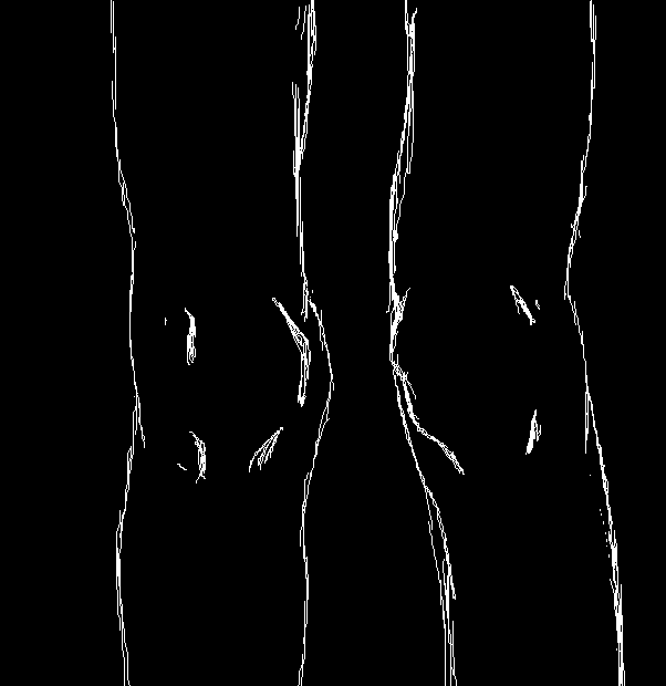 Deviantart Knees Knees by GeckoPeels on DeviantArt