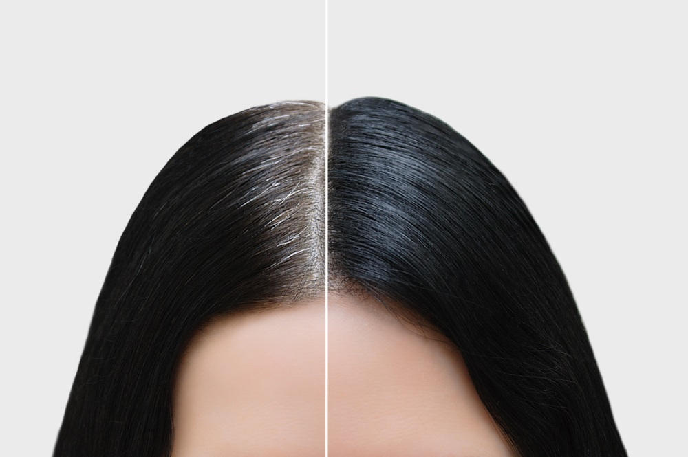 Grey-hair
