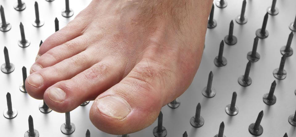 Нейропатия пальцев. Ногти на ногах при полинейропатии. Диабетическая полинейропатия картинки. Диабетическая невропатия фото.