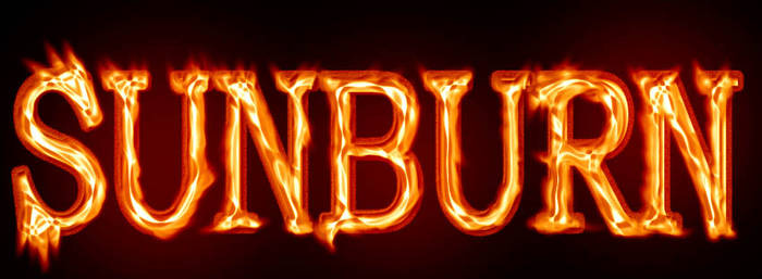 Sunburn Logo -1