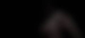 Slightly Parasitic GIF