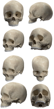 Skull without jaw Stock