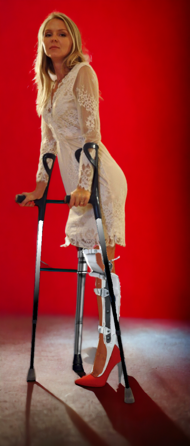 Peg leg and a brace by SharpenAndCarve on DeviantArt