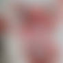 Holly Hemoglobin (cropped)
