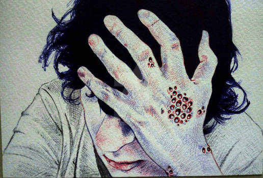 Trypophobia