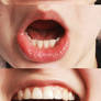 Mouth2