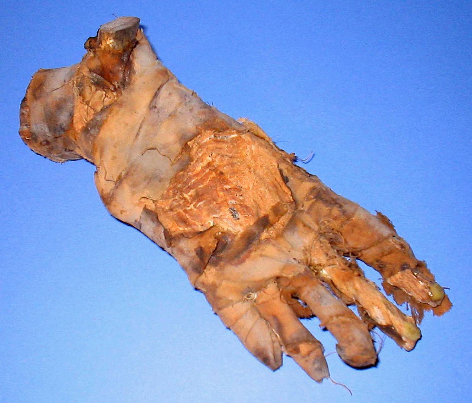 Mummy Foot 1 by DETHCHEEZ