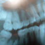 Dental X-Ray Texture